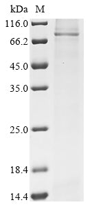Greater than 85% as determined by SDS-PAGE.Recombinant Human ABCD3 Protein (N-10xHis)