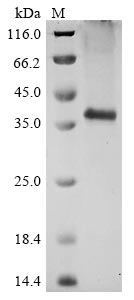 Greater than 90% as determined by SDS-PAGE.Recombinant Human C5AR1 Protein (C-10xHis)