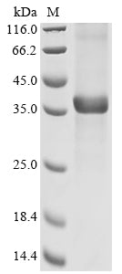 Greater than 85% as determined by SDS-PAGE.Recombinant Human EPHX4 Protein (N-10xHis)