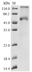 Greater than 90% as determined by SDS-PAGE.Recombinant Human BTNL2 Protein (N-10xHis)