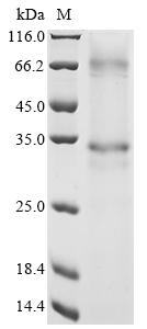Greater than 85% as determined by SDS-PAGE.Recombinant Human RCE1 Protein (N-10xHis)