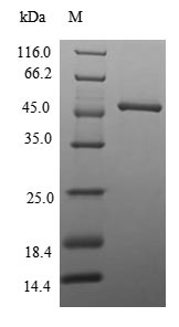 Greater than 85% as determined by SDS-PAGE.Recombinant Human N-Terminal Xaa-Pro-Lys N-Methyltransferase 1 (NTMT1) Protein (GST), Active