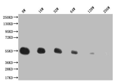 Western Blot Positive WB detected in: 200ng recombinant protein with His tag His antibody at 1:8w, 1:16w, 1:32w, 1:64w, 1:128w, 1:256w Secondary Goat polyclonal to mouse IgG at 1/50000 dilution Predicted band size: 43.4 KDa Observed band size: 43.4 KDa Exposure time：5minMouse His Monoclonal Antibody