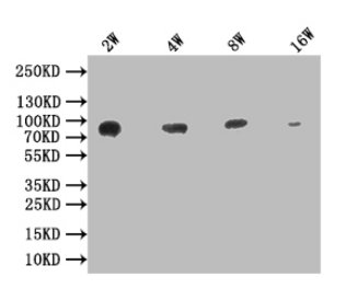 Western Blot Positive WB detected in: 200ng recombinant protein with His tag His antibody at 1:2w, 1:4w, 1:8w, 1:16w, 1:32w, 1:64w Secondary Goat polyclonal to mouse IgG at 1/50000 dilution Predicted band size:62.5 KDa Observed band size: 66 KDa Exposure time：5minMouse His Monoclonal Antibody