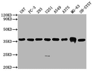 Western BlotPositive WB detected in: U87 whole cell lysate, PC-3 whole cell lysate, 293 whole cell lysate, U251 whole cell lysate, A549 whole cell lysate, A375 whole cell lysate, MG-63 whole cell lysate, SH-SY5Y whole cell lysate,All lanes GAPDH antibody at 1:5000SecondaryGoat polyclonal to mouse IgG at 1/50000 dilutionPredicted band size: 36 KDaObserved band size: 36 KDaExposure time: 10sMouse anti-Human GAPDH Monoclonal Antibody antibody