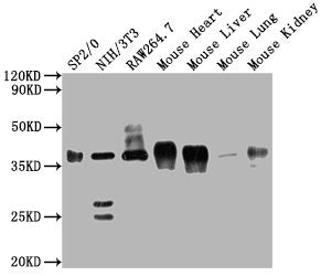 Western BlotPositive WB detected in: SP2/0 whole cell lysate, NIH/3T3 whole cell lysate, Raw264.7 whole cell lysate, Mouse Heart tissue, Mouse lung tissue,Mouse kidney tissueAll lanes GAPDH antibody at 1:5000SecondaryGoat polyclonal to mouse IgG at 1/50000 dilutionPredicted band size: 36 KDaObserved band size: 36 KDaExposure time: 10sMouse anti-Human GAPDH Monoclonal Antibody antibody