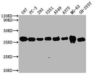 Western BlotPositive WB detected in: U87 whole cell lysate, PC3 whole cell lysate, 293 whole cell lysate, U251 whole cell lysate, A549 whole cell lysate, MG-63 whole cell lysate, U251 whole cell lysate, SH-SY5Y whole cell lysate All lanes GAPDH antibody at 1:5000SecondaryGoat polyclonal to mouse IgG at 1/50000 dilutionPredicted band size: 36 KDaObserved band size: 36 KDaExposure time: 5minMouse anti-Human GAPDH Monoclonal antibody