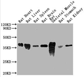 Western BlotPositive WB detected in: Rat heart tissue, Rat liver tissue, Rat spleen tissue, Rat brain tissue, Rat skeletal tissue, Rat stomach tissue, Rat kidney tissue All lanes GAPDH antibody at 1:5000SecondaryGoat polyclonal to mouse IgG at 1/50000 dilutionPredicted band size: 36 KDaObserved band size: 36 KDaExposure time: 5minMouse anti-Human GAPDH Monoclonal antibody