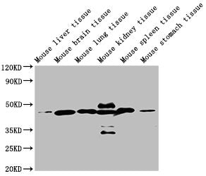 Western Blot Positive WB detected in: Mouse liver tissue, Mouse brain tissue, Mouse lung tissue, Mouse kidney tissue, Mouse spleen tissue, Mouse stomach tissue  All lanes: ACTB antibody at 1:5000 Secondary Goat polyclonal to mouse IgG at 1/50000 dilution Predicted band size: 42 KDa Observed band size: 42 KDa Exposure time：5min