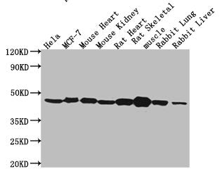 Western Blot Positive WB detected in: Hela whole cell lysate, MCF-7 whole cell lysate, Mouse heart tissue, Mouse kidney tissue, Rat heart tissue, Rat skeletal muscle tissue, Rabbit lung tissue, Rabbit liver tissue All lanes: ACTB antibody at 1:5000 Secondary Goat polyclonal to mouse IgG at 1/50000 dilution Predicted band size: 42 KDa Observed band size: 42 KDa Exposure time：5minMouse ACTB Monoclonal Antibody