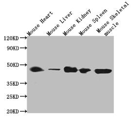 Western Blot Positive WB detected in: Mouse heart tissue, Mouse liver tissue, Mouse kidney tissue, Mouse spleen tissue, Mouse skeletal muscle tissue All lanes: ACTB antibody at 1:5000 Secondary Goat polyclonal to mouse IgG at 1/50000 dilution Predicted band size: 42 KDa Observed band size: 42 KDa Exposure time：5minMouse ACTB Monoclonal Antibody