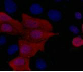 IF analysis of 293 cells transfected with a His-tag protein,1:1000 dilution (blue DAPI, red anti-His)Mouse His-Tag Monoclonal Antibody