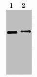 2µg His fusion protein + Primary antibody dilution at  1) 1:5000 2) 1:10000Mouse His-Tag Monoclonal Antibody