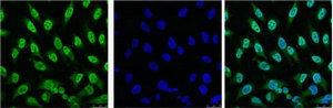 IF analysis of Hela with antibody (Left) and DAPI (Right) diluted at 1:100.Mouse anti-H TP53 Monoclonal Antibody