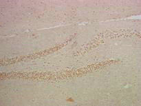 IHC staining of mouse hippocampus tissue, diluted at 1:200.Mouse anti-Human RELA Monoclonal Antibody