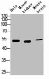 Western blot analysis of 1) Hela, 2) Mouse Kidney, 3) Mouse Brain, diluted at 1:2000.