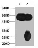 1) Input: Mouse Brain Tissue Lysate  | 2) IP product: IP dilute 1: 200Mouse anti-Human TUBB3 Monoclonal Antibody