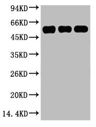 Western blot analysis of 1) Hela, 2) Mouse Kidney tissue, 3) Rat Heart tissue, diluted at 1:5000.Mouse anti-Human TUBB3 Monoclonal Antibody