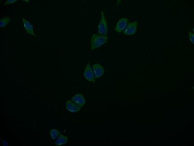 Immunofluorescence staining of Hela cells with ABCB1 Monoclonal Antibody at 1:100, counter-stained with DAPI. The cells were fixed in 4% formaldehyde and blocked in 10% normal Goat Serum. The cells were incubated with the antibody overnight at 4°C. Nuclear DNA was labeled in blue with DAPI. The secondary antibody was FITC-conjugated AffiniPure Goat Anti-Mouse IgG (H+L).