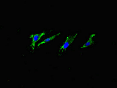 Immunofluorescent analysis of Hela cells using APP Monoclonal Antibody at dilution of 1:100 and Alexa Fluor 488-congugated AffiniPure Goat Anti-Rabbit IgG(H+L)Mouse anti-Human APP Monoclonal antibody
