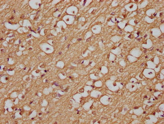 Immunohistochemistry of paraffin-embedded human brain tissue using APP Monoclonal Antibody at dilution of 1:200Mouse anti-Human APP Monoclonal antibody