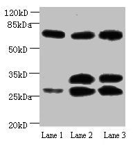 Western blotAll lanes: Amyloid beta A4 antibody at 1µg/mlLane 1: Mouse heart tissueLane 2: Mouse kidney tissueLane 3: Mouse lung tissueSecondaryGoat polyclonal to Mouse IgG at 1/15000 dilutionPredicted band size: 30, 35, 72, 80 kDaObserved band size: 30, 35, 72 kDaMouse anti-Human APP Monoclonal antibody