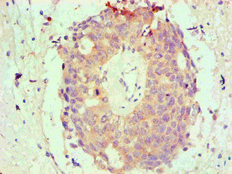Immunohistochemical of paraffin-embedded Human endometrium tissue using the antibody at dilution of 1:200mouse anti-Human BCL2L1 monoclonal antibody