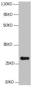 All Lanes:Mouse anti BCL2L1 Monoclonal antibody at 1μg/mlLane 1:HepG2 whole cell lysateSecondary Goat polyclonal to Mouse IgG at 1/5000 dilutionPredicted band size:26,27,19kdObserved band size:26KDmouse anti-Human BCL2L1 monoclonal antibody