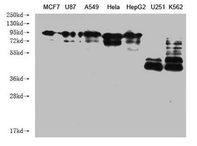 Immunofluorescence staining of Hela cells with CANX CANX Monoclonal Antibody at 1:140, counter-stained with DAPI. The cells were fixed in 4% formaldehyde and blocked in 10% normal Goat Serum. The cells were incubated with the antibody overnight at 4°C. Nuclear DNA was labeled in blue with DAPI. The secondary antibody was FITC-conjugated AffiniPure Goat Anti-Mouse IgG (H+L).Mouse anti-Human CANX Monoclonal antibody