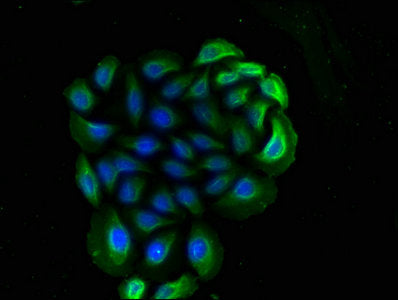 Immunofluorescence staining of A549 cells with CD14 Monoclonal Antibody at 1:90, counter-stained with DAPI. The cells were blocked in 10% normal Goat Serum and then incubated with the primary antibody overnight at 4°C. The secondary antibody was Alexa Fluor 488-congugated AffiniPure Goat Anti-Mouse IgG(H+L).Mouse anti-Human CD14 Monoclonal antibody