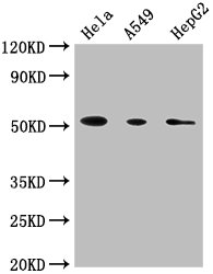 Western BlotPositive WB detected in: Hela whole cell lysate, A549 whole cell lysate, HepG2 whole cell lysateAll lanes: CD14 antibody at 1:1800SecondaryGoat polyclonal to Mouse IgG at 1/10000 dilutionPredicted band size: 41 kDaObserved band size: 55 kDaMouse anti-Human CD14 Monoclonal antibody