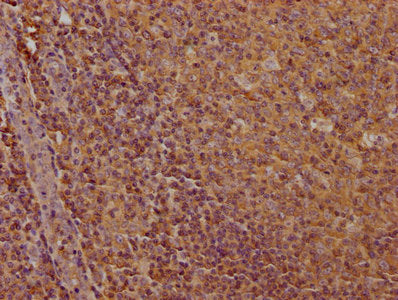 IHC image of CD19 Monoclonal Antibody diluted at 1:100 and staining in paraffin-embedded human tonsil tissue performed on a Leica BondTM system. After dewaxing and hydration, antigen retrieval was mediated by high pressure in a citrate buffer (pH 6.0). Section was blocked with 10% normal goat serum 30min at RT. Then primary antibody (1% BSA) was incubated at 4°C overnight. The primary is detected by a biotinylated secondary antibody and visualized using an HRP conjugated SP system.Mouse anti-Human CD19 Monoclonal antibody