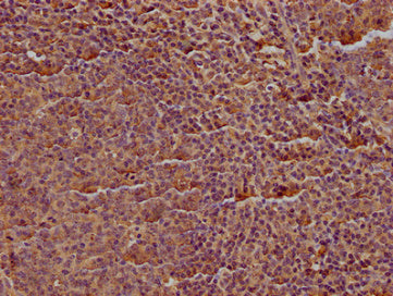 IHC image of CD19 Monoclonal Antibody diluted at 1:100 and staining in paraffin-embedded human tonsil tissue performed on a Leica BondTM system. After dewaxing and hydration, antigen retrieval was mediated by high pressure in a citrate buffer (pH 6.0). Section was blocked with 10% normal goat serum 30min at RT. Then primary antibody (1% BSA) was incubated at 4°C overnight. The primary is detected by a biotinylated secondary antibody and visualized using an HRP conjugated SP system.Mouse anti-Human CD19 Monoclonal antibody