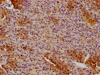 IHC image of CD19 Monoclonal Antibody diluted at 1:100 and staining in paraffin-embedded human spleen tissue performed on a Leica BondTM system. After dewaxing and hydration, antigen retrieval was mediated by high pressure in a citrate buffer (pH 6.0). Section was blocked with 10% normal goat serum 30min at RT. Then primary antibody (1% BSA) was incubated at 4°C overnight. The primary is detected by a biotinylated secondary antibody and visualized using an HRP conjugated SP system.Mouse anti-Human CD19 Monoclonal antibody