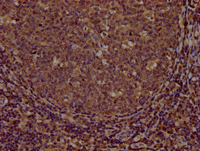 IHC image of CD44 Monoclonal Antibody diluted at 1:100 and staining in paraffin-embedded human tonsil tissue performed on a Leica BondTM system. After dewaxing and hydration, antigen retrieval was mediated by high pressure in a citrate buffer (pH 6.0). Section was blocked with 10% normal goat serum 30min at RT. Then primary antibody (1% BSA) was incubated at 4°C overnight. The primary is detected by a biotinylated secondary antibody and visualized using an HRP conjugated SP system.Mouse anti-Human CD44 Monoclonal antibody