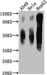 Western Blot Positive WB detected in: A549 whole cell lysate, Hela whole cell lysate, HepG2 whole cell lysate  All lanes CD63 antibody at 1:1000 Secondary Goat polyclonal to mouse IgG at 1/50000 dilution Predicted band size: 30-120 KD KDa Observed band size: 30-120 KD KDa Exposure time:1minMouse anti-Human CD63 Monoclonal Antibody antibody