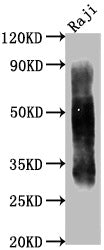 Western Blot Positive WB detected in: Raji whole cell lysate All lanes CD63 antibody at 1:1000 Secondary Goat polyclonal to mouse IgG at 1/50000 dilution Predicted band size: 30-120 KD KDa Observed band size: 30-120 KD KDa Exposure time:1minMouse anti-Human CD63 Monoclonal Antibody antibody