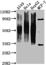 Western Blot Positive WB detected in: A549 whole cell lysate, Hela whole cell lysate, HepG2 whole cell lysate, MCF-7 whole cell lysate  All lanes CD63 antibody at 1:1000 Secondary Goat polyclonal to mouse IgG at 1/50000 dilution Predicted band size: 30-120 KD KDa Observed band size: 30-120 KD KDa Exposure time:1minMouse anti-Human CD63 Monoclonal Antibody antibody