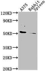 Western Blot Positive WB detected in: A375 whole cell lysate, Rabbit spleen tissue  All lanes CD63 antibody at 1:1000 Secondary Goat polyclonal to mouse IgG at 1/50000 dilution Predicted band size: 30-120 KD KDa Observed band size: 30-120 KD KDa Exposure time:1min`Mouse anti-Human CD63 Monoclonal Antibody antibody