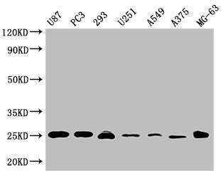 Western Blot Positive WB detected in: U87 whole cell lysate, PC3 whole cell lysate, 293 whole cell lysate, U251 whole cell lysate, A549 whole cell lysate, A375 whole cell lysate, MG-63 whole cell lysate  All lanes CD9 antibody at 1:2000 Secondary Goat polyclonal to mouse IgG at 1/50000 dilution Predicted band size: 25 KDa Observed band size: 25 KDa Exposure time:5minMouse anti-Human CD9 Monoclonal antibody