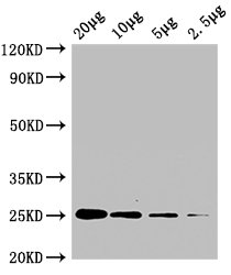 Western Blot Positive WB detected in: A549 whole cell lysate at 20μg, 10μg, 5μg, 2.5μg All lanes: CD9 antibody at 1:2000 Secondary Goat polyclonal to mouse IgG at 1/50000 dilution Predicted band size: 25 KDa Observed band size: 25 KDa Exposure time:10minMouse anti-Human CD9 Monoclonal antibody
