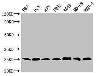 Western Blot Positive WB detected in: U87 whole cell lysate, PC-3 whole cell lysate, 293 whole cell lysate, U251 whole cell lysate, A549 whole cell lysate, MG-63 whole cell lysate, MCF-7 whole cell lysate  All lanes CD9 antibody at 1:2000 Secondary Goat polyclonal to mouse IgG at 1/50000 dilution Predicted band size: 25 KDa Observed band size: 25 KDa Exposure time: 5minMouse anti-Human CD9 Monoclonal antibody