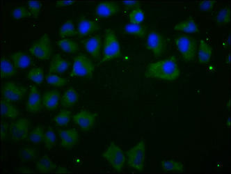 Immunofluorescence staining of Hela cells with CDH1 Monoclonal Antibody at 1:100, counter-stained with DAPI. The cells were blocked in 10% normal Goat Serum and then incubated with the primary antibody overnight at 4°C. The secondary antibody was Alexa Fluor 488-congugated AffiniPure Goat Anti-Mouse IgG(H+L).Mouse anti-Human CDH1 Monoclonal Antibody