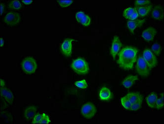 Immunofluorescence staining of MCF-7 cells with CDH1 Monoclonal Antibody at 1:100, counter-stained with DAPI. The cells were blocked in 10% normal Goat Serum and then incubated with the primary antibody overnight at 4°C. The secondary antibody was Alexa Fluor 488-congugated AffiniPure Goat Anti-Mouse IgG(H+L).Mouse anti-Human CDH1 Monoclonal Antibody
