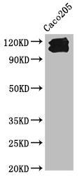 Western Blot  | Positive WB detected in: Caco205 whole cell lysate  | All lanes: CDH1 antibody at 1:1000  | Secondary  | Goat polyclonal to Mouse IgG at 1/10000 dilution  | Predicted band size: 98, 91 kDa  | Observed band size: 110, 120 kDaMouse anti-Human CDH1 Monoclonal Antibody