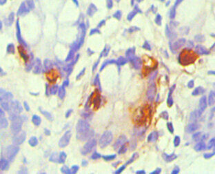 Immunohistochemical of paraffin-embedded Human small intestine tissue using the antibody at dilution of 1:200.mouse anti-Human CHGA Monoclonal Antibody