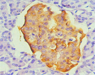 Immunohistochemical of paraffin-embedded Human pancreas tissue using CHGA Monoclonal Antibody(1D7-3D5) at dilution of 1:200.mouse anti-Human CHGA Monoclonal Antibody