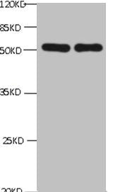 All lanes: Chromogranin-A transfected E.coli lysate | lane 1:Mouse Anti--6*his monoclonal antibody at 1μg/ml | lane 2 : Mouse anti- Chromogranin-A monoclonal antibody at 1μg/ml | Predicted band size : 52Kd | Observed band size : 52kdmouse anti-Human CHGA Monoclonal Antibody