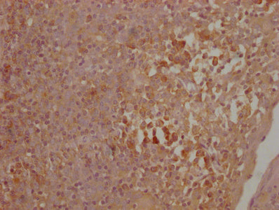 IHC image of CTLA4 Monoclonal Antibody diluted at 1:500 and staining in paraffin-embedded human lymph node tissue performed on a Leica BondTM system. After dewaxing and hydration, antigen retrieval was mediated by high pressure in a citrate buffer (pH 6.0). Section was blocked with 10% normal goat serum 30min at 37°C Then primary antibody (1% BSA) was incubated at 4°C overnight. The primary is detected by a Goat anti-Mouse IgG labeled by HRP and visualized using 0.05% DAB.Mouse anti-Human CTLA4 Monoclonal antibody
