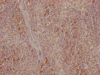 IHC image of CTLA4 Monoclonal Antibody diluted at 1:500 and staining in paraffin-embedded human tonsil tissue performed on a Leica BondTM system. After dewaxing and hydration, antigen retrieval was mediated by high pressure in a citrate buffer (pH 6.0). Section was blocked with 10% normal goat serum 30min at 37°C Then primary antibody (1% BSA) was incubated at 4°C overnight. The primary is detected by a Goat anti-Mouse IgG labeled by HRP and visualized using 0.05% DAB.Mouse anti-Human CTLA4 Monoclonal antibody